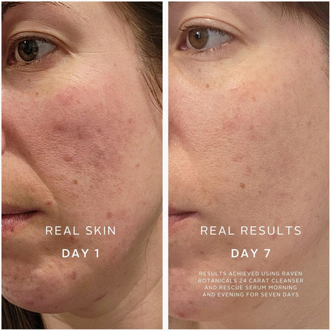 Rescue Serum