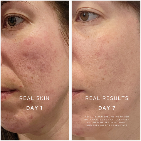 Soothing Superheroes