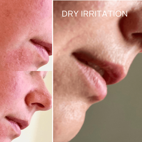 Rescue Serum - Raven Botanicals