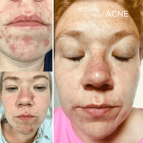 Rescue Serum - Raven Botanicals