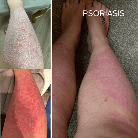 Rescue Serum - Reusable Glass Pipette - Raven Botanicals - Made Scotland