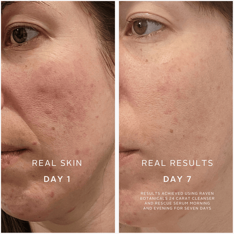 Soothing Superheroes - Raven Botanicals - Made Scotland